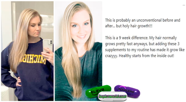 feedback of Bethany about supplements of B-Epic