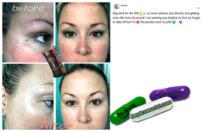 Andrea writes about REJUVEN8 serum of B-Epic 