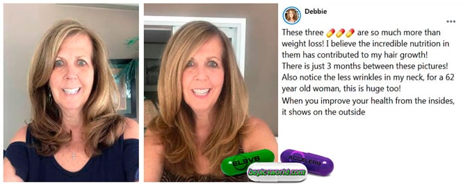Debbie writes about 3 pills of B-Epic