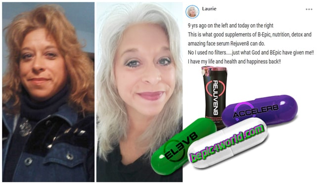 Feedback of Laurie about supplements of B-Epic and serum Rejuven8