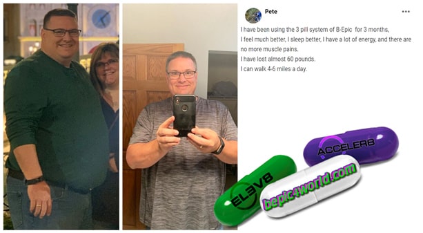 Pete writes about using 3 pill system of B-Epic
