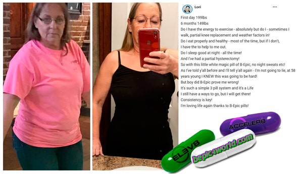 Lori writes about 3 pill system of B-Epic
