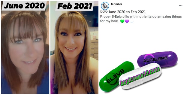 Jenni writes about the benefits of B-Epic pills for hair health