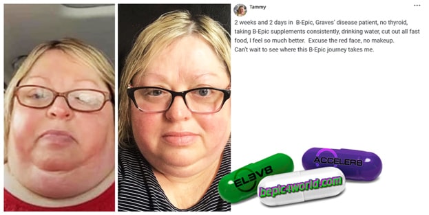 Feedback of Tammy about B-Epic supplements