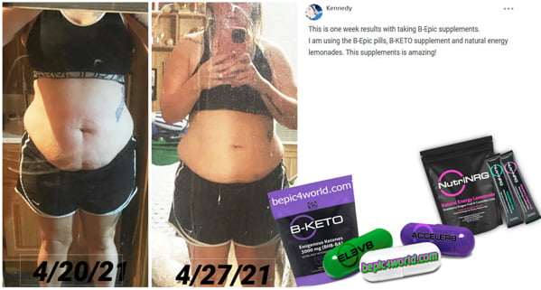 Feedback of Kennedy about B-Epic supplements