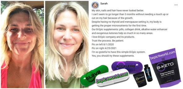 Feedback of Sarah about B-Epic supplements